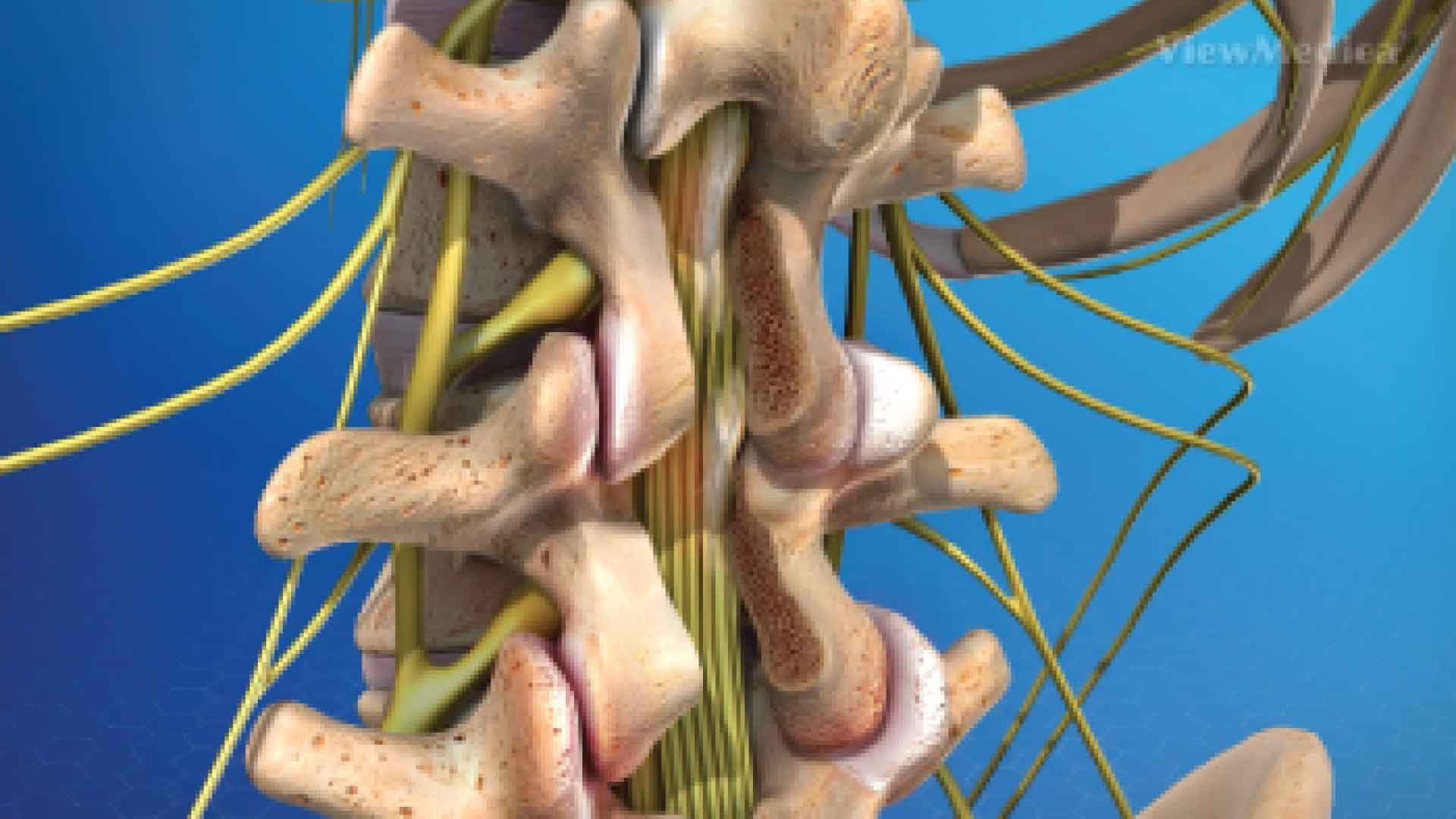 Post spinal surgery pain
